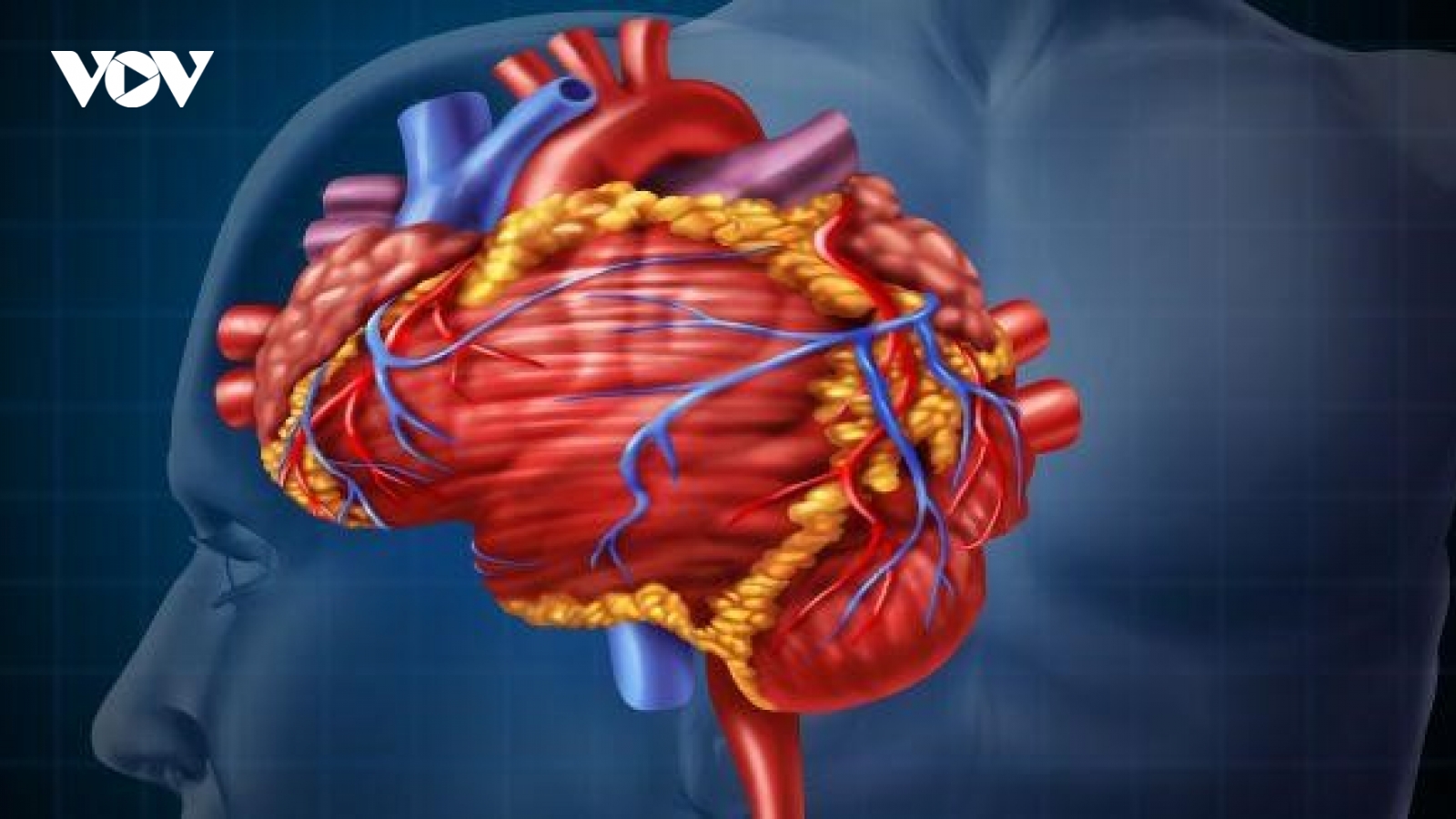 Cách phòng ngừa đột quỵ hiệu quả