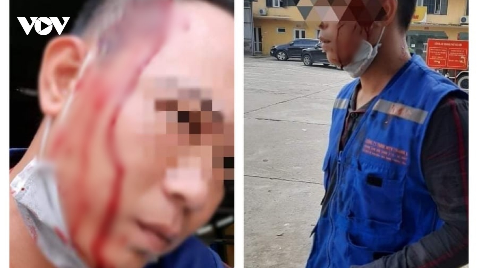 Đối tượng côn đồ cầm kéo đâm người trước cổng trụ sở công an 