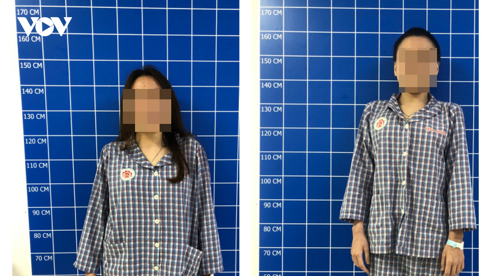 Cong vẹo cột sống, cô gái 22 tuổi mang "khối mai rùa" trên cơ thể