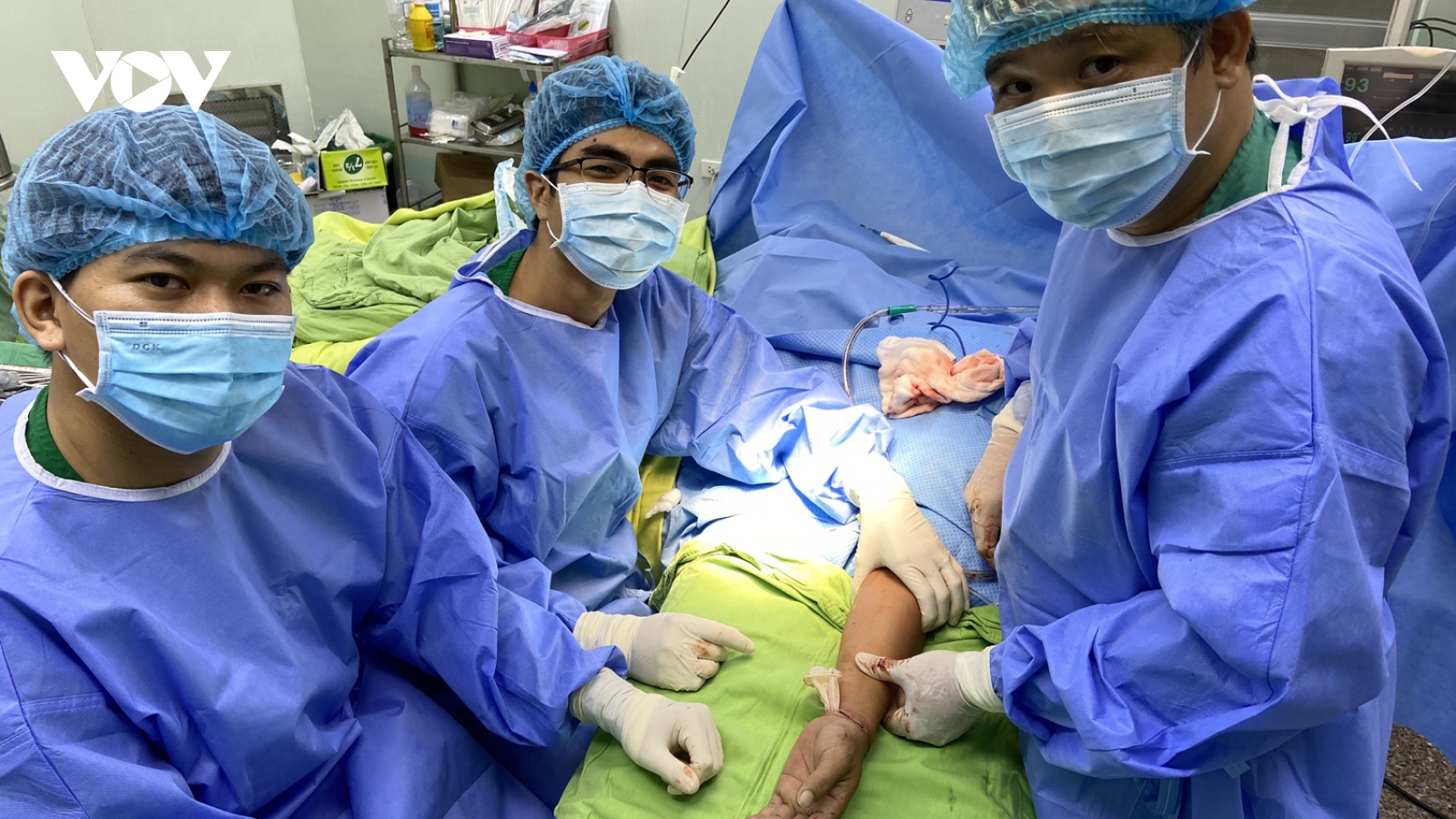 Phẫu thuật thành công cho một bệnh nhân đứt lìa bàn tay