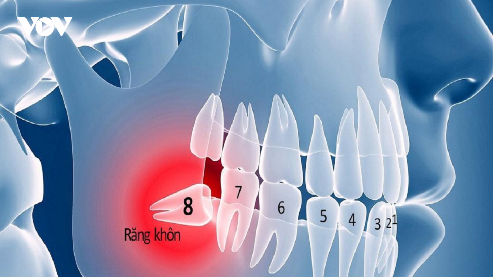 Nhổ răng khôn có thể cải thiện vị giác của bạn?