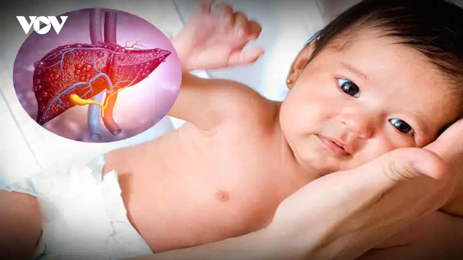 Viêm gan ở trẻ em và những điều bạn nên biết