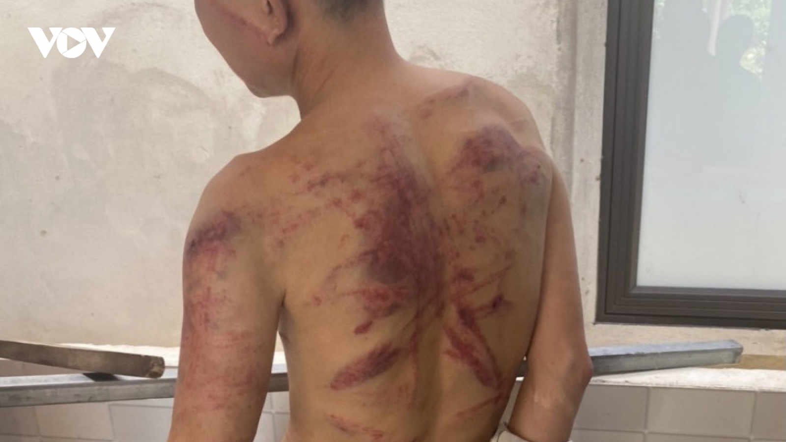 “Nữ quái” cho vay nặng lãi, dùng dây điện “tra tấn” con nợ