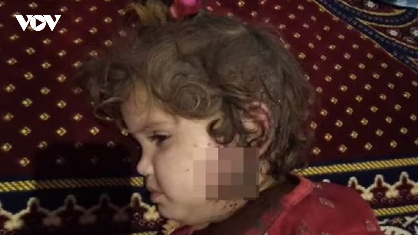 Cựu Bộ trưởng Afghanistan đăng hình ảnh tố Taliban giết hại trẻ em vô tội