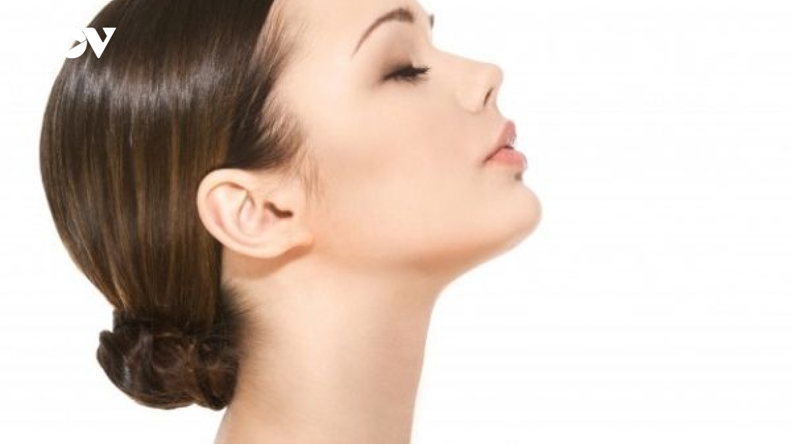 Trị mụn ở vùng quai hàm với 5 mẹo cực kỳ hiệu quả