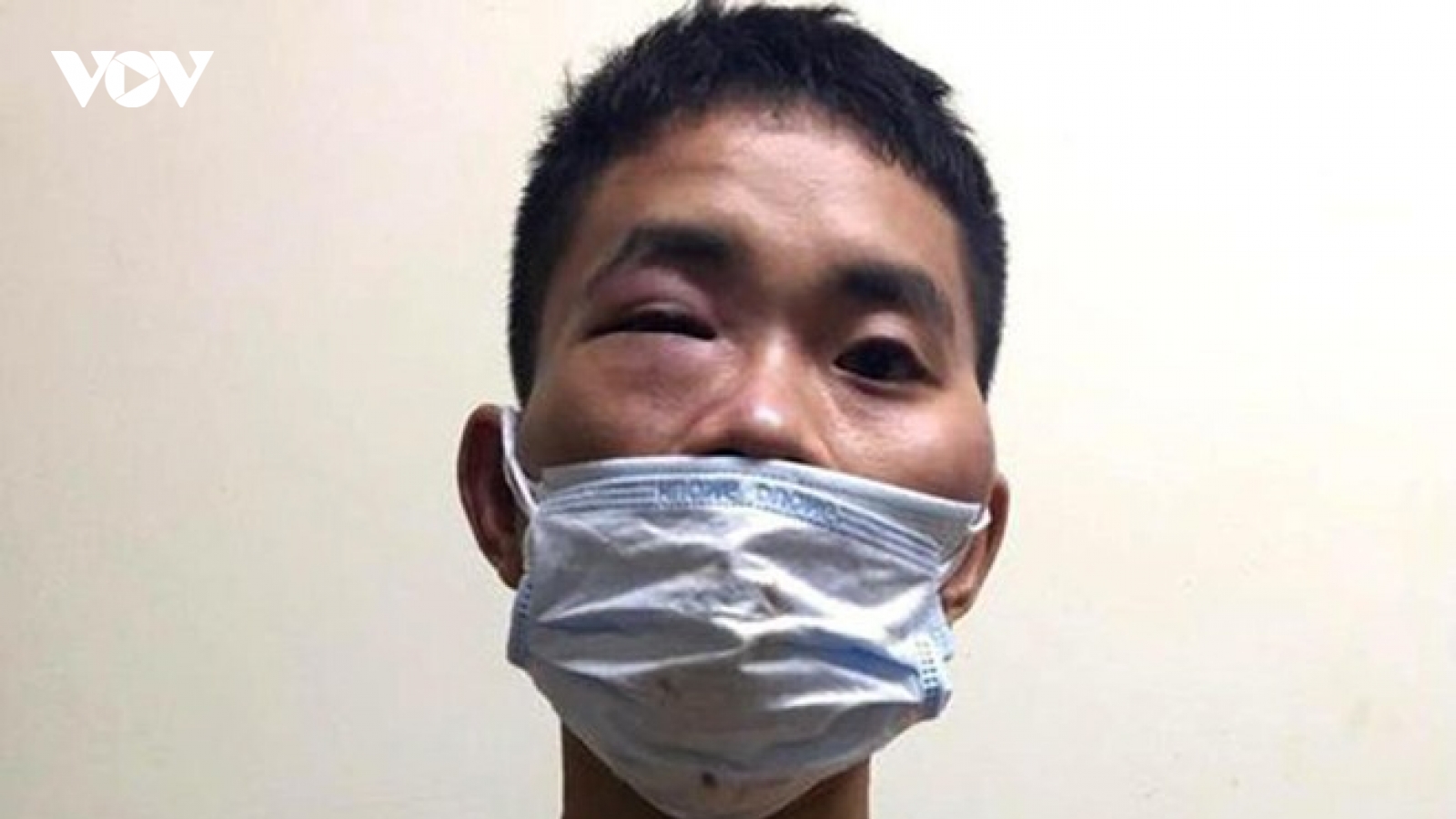 Đối tượng nghi “ngáo đá” túm tóc cán bộ trực chốt đòi lại xe máy