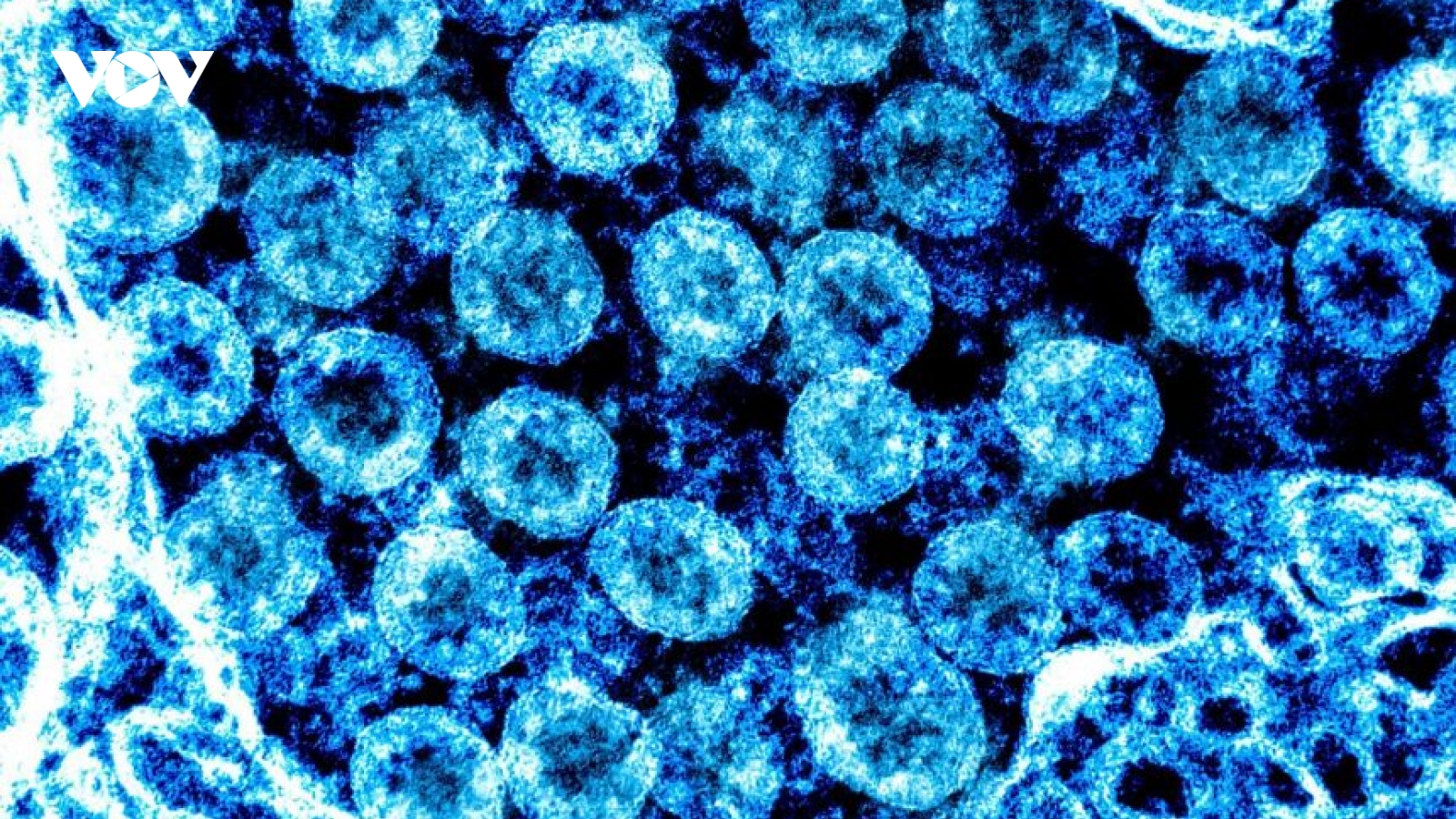 Phát hiện quan trọng về virus SARS-CoV-2 giúp phát triển thuốc chữa Covid-19