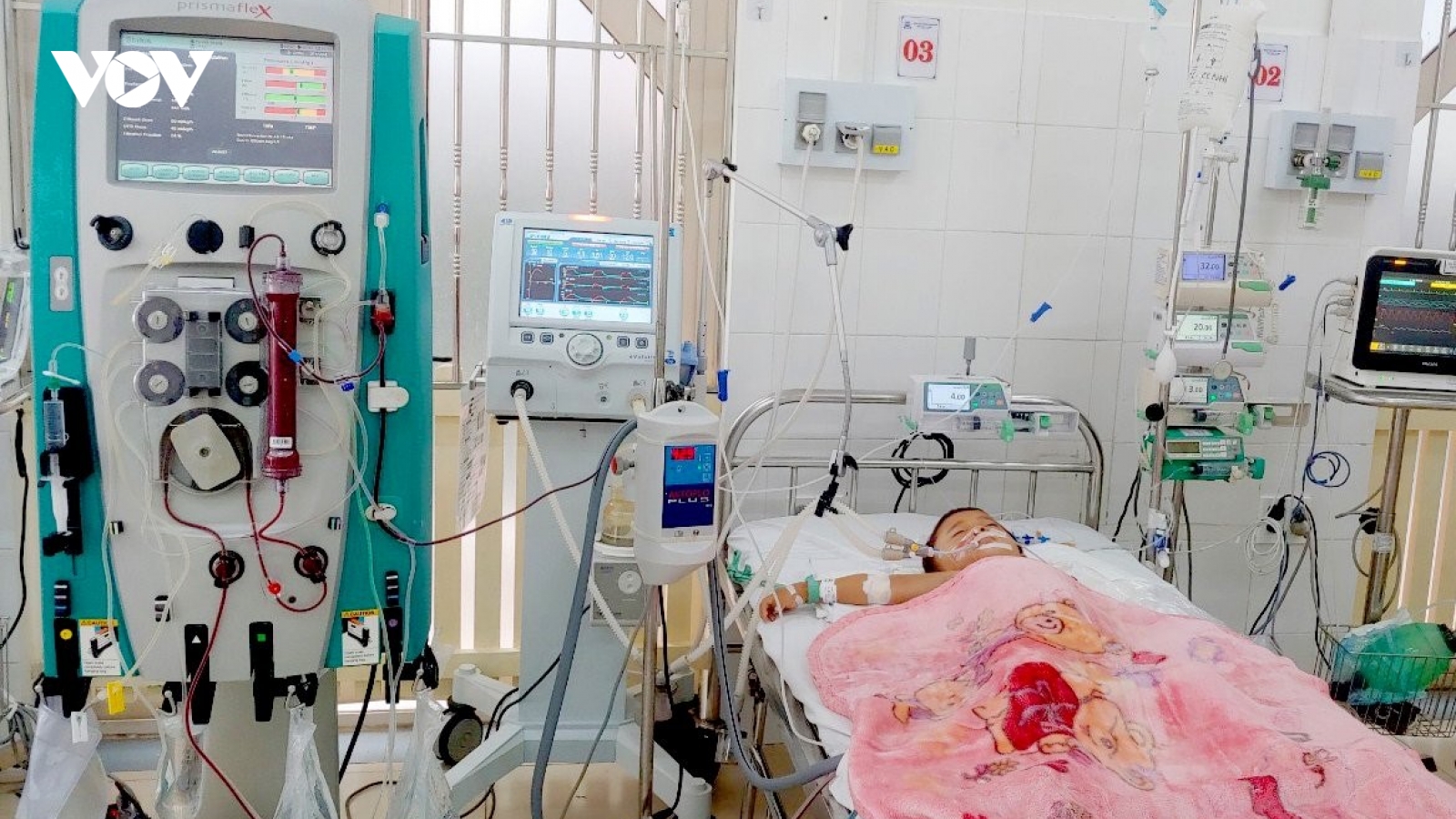 Cháu bé 5 tuổi ở Thừa Thiên - Huế bị ong vò vẽ đốt 50 mũi được xuất viện