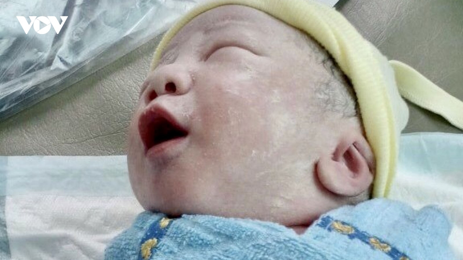 Mổ đẻ thành công cho thai phụ mắc Covid-19 ở Hậu Giang