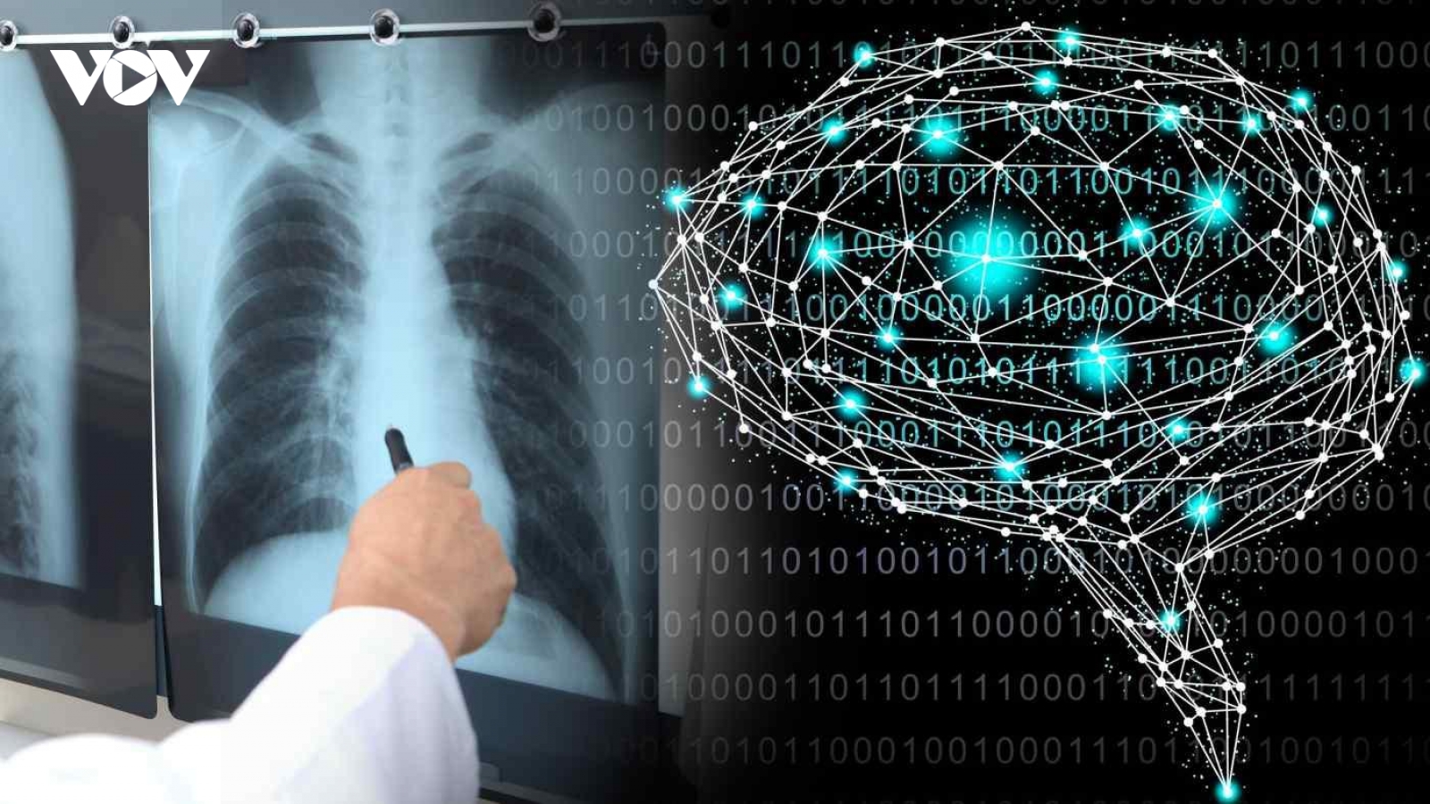 Nhật Bản nới lỏng quy định về phần mềm trí tuệ nhân tạo y tế