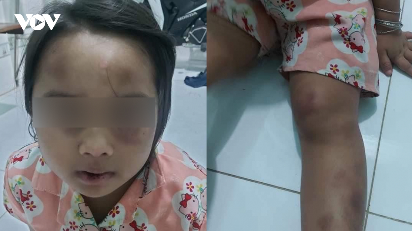 Bạo hành trẻ em phải bị trừng trị nghiêm minh