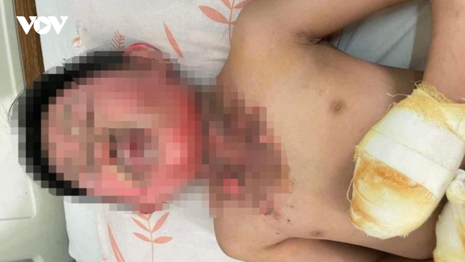 Khởi tố người cha đổ xăng tự thiêu cùng con trai do mâu thuẫn với vợ