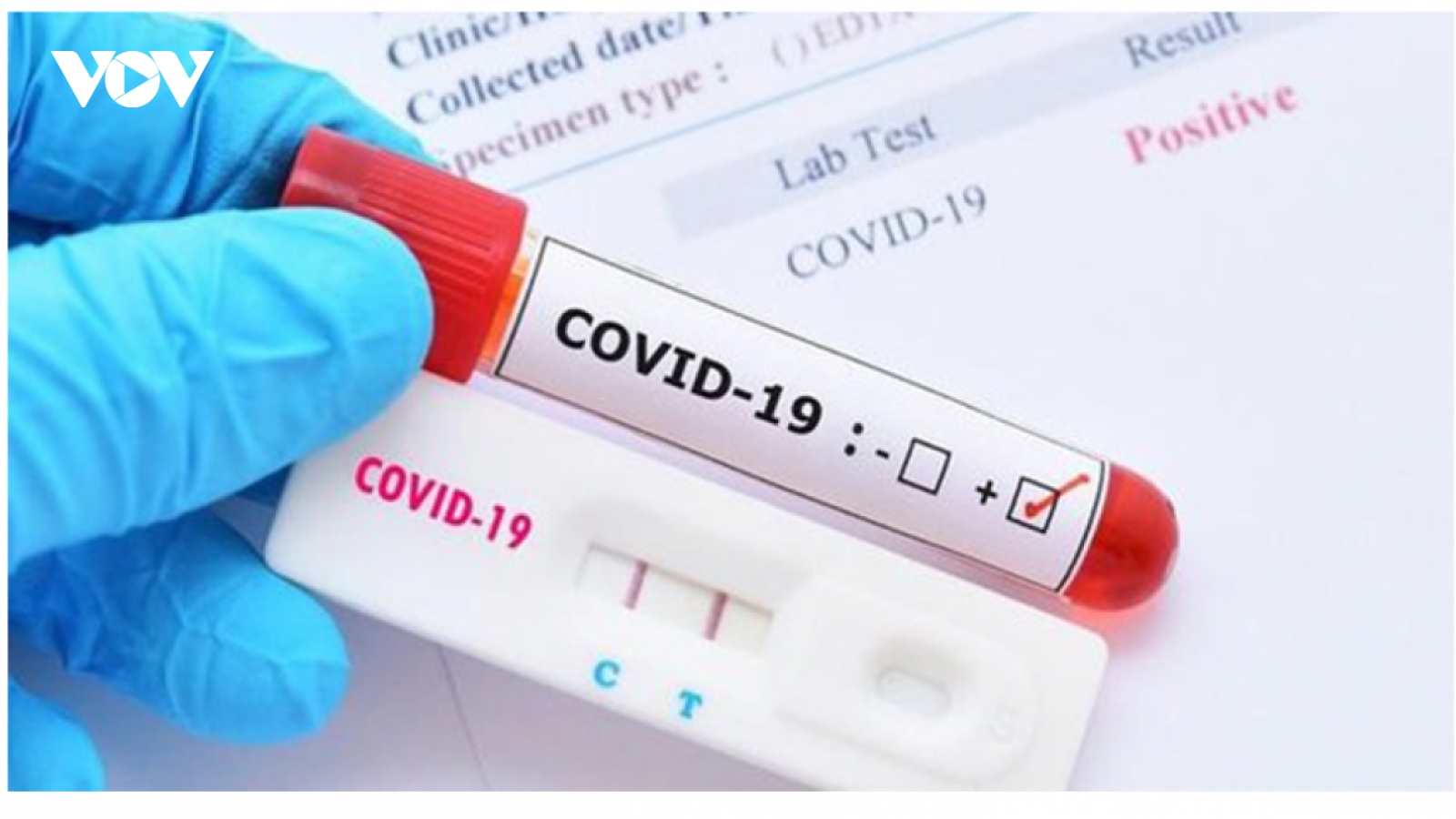 Chuyển Covid-19 từ nhóm A sang B: Không nóng vội nhưng cũng đừng quá cầu toàn
