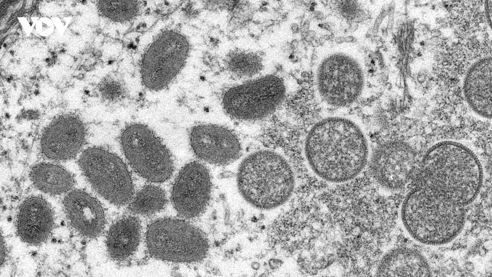 Xuất hiện bệnh đậu mùa khỉ ở nhiều nước, WHO họp khẩn