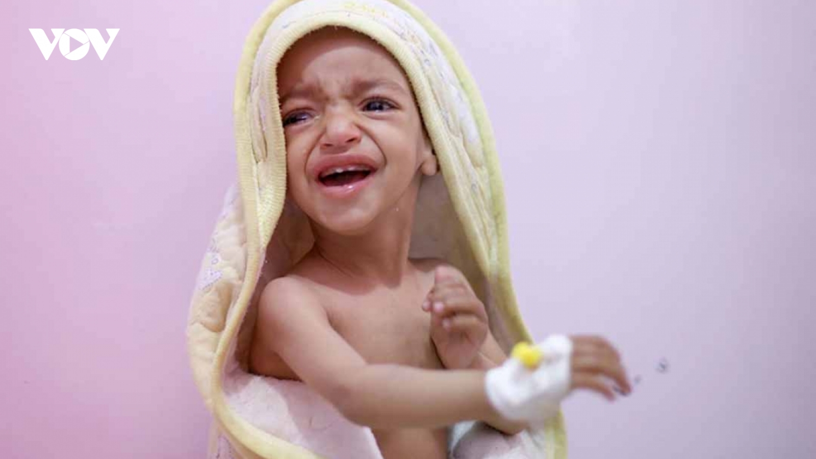 Bệnh đường tiêu hóa và vấn đề suy dinh dưỡng ở trẻ