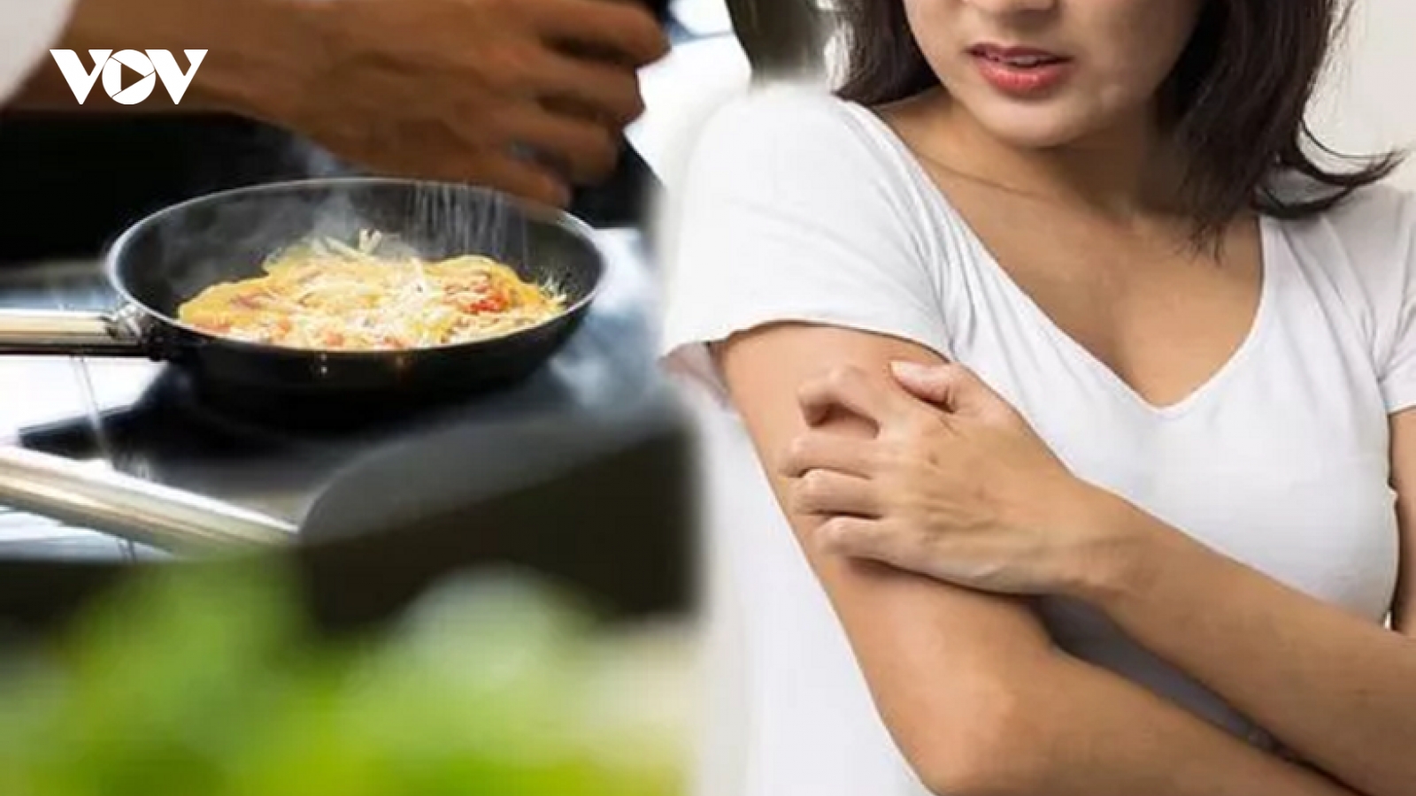 Nên và không nên ăn gì khi bị bệnh zona?