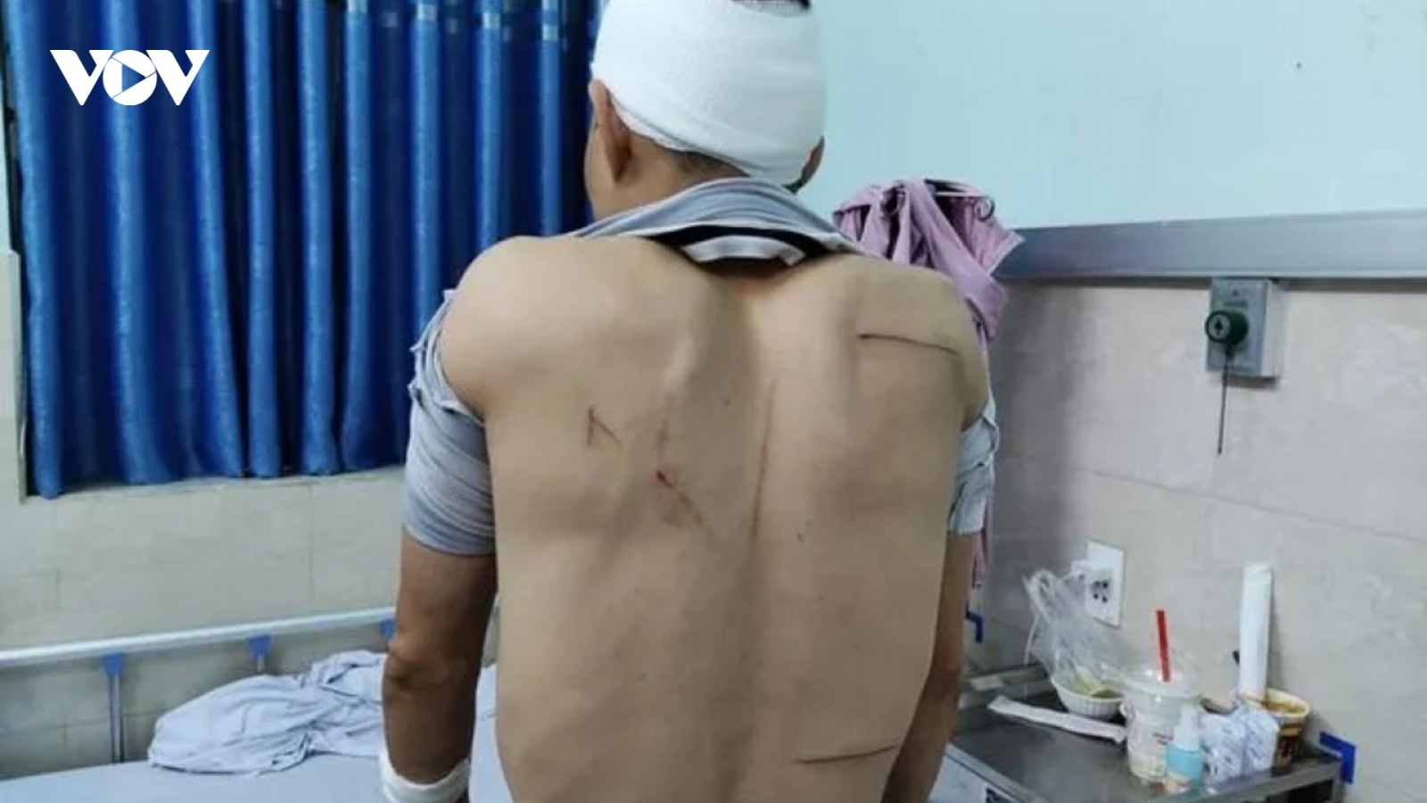 Nhóm côn đồ mang dao kiếm vào cổng bệnh viện, hành hung người dân
