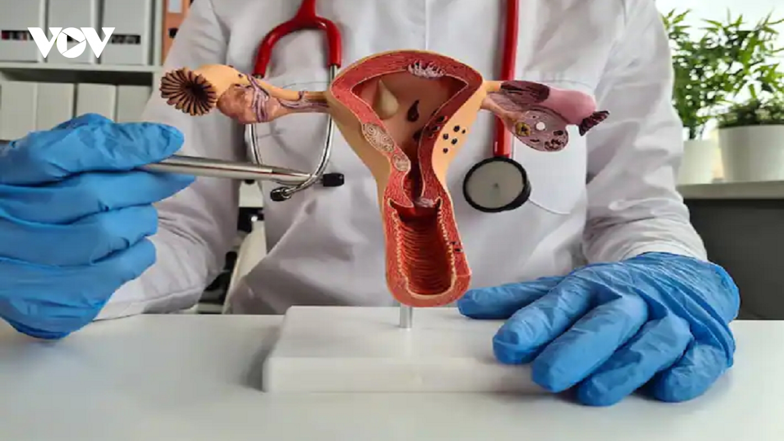 7 điều phụ nữ nên làm để chăm sóc sức khỏe sinh sản và tình dục