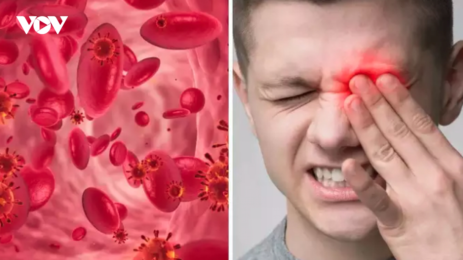 Thiếu sắt, đừng bỏ qua dấu hiệu bên trong mí mắt dưới của bạn