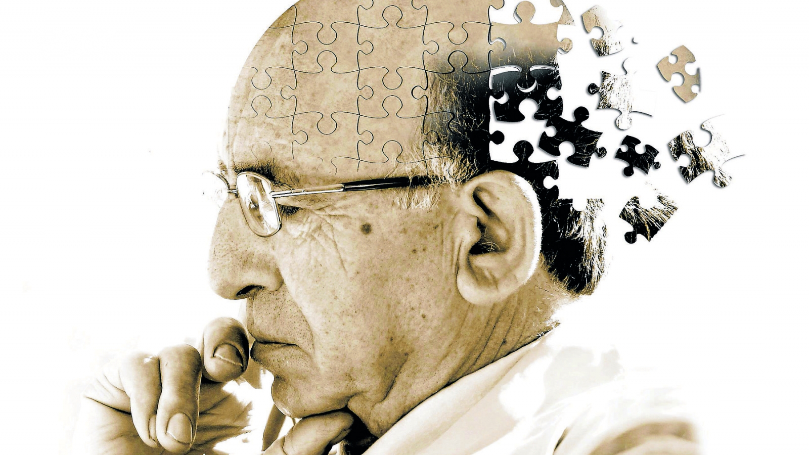Dấu hiệu và triệu chứng của bệnh Alzheimer đừng bỏ qua