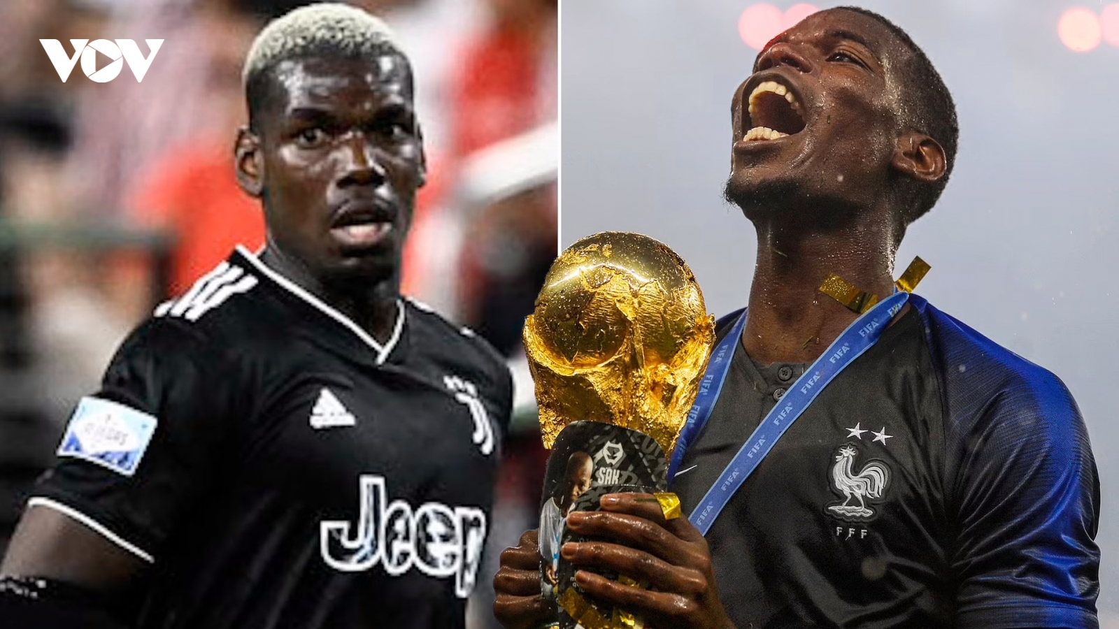 Pogba từ chối phẫu thuật để nuôi hy vọng dự World Cup 2022