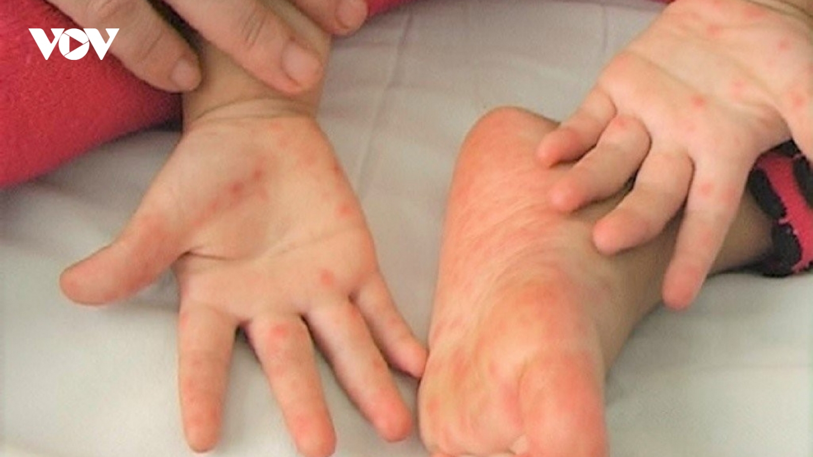 Những lưu ý khi phòng bệnh cho trẻ lúc giao mùa thu đông