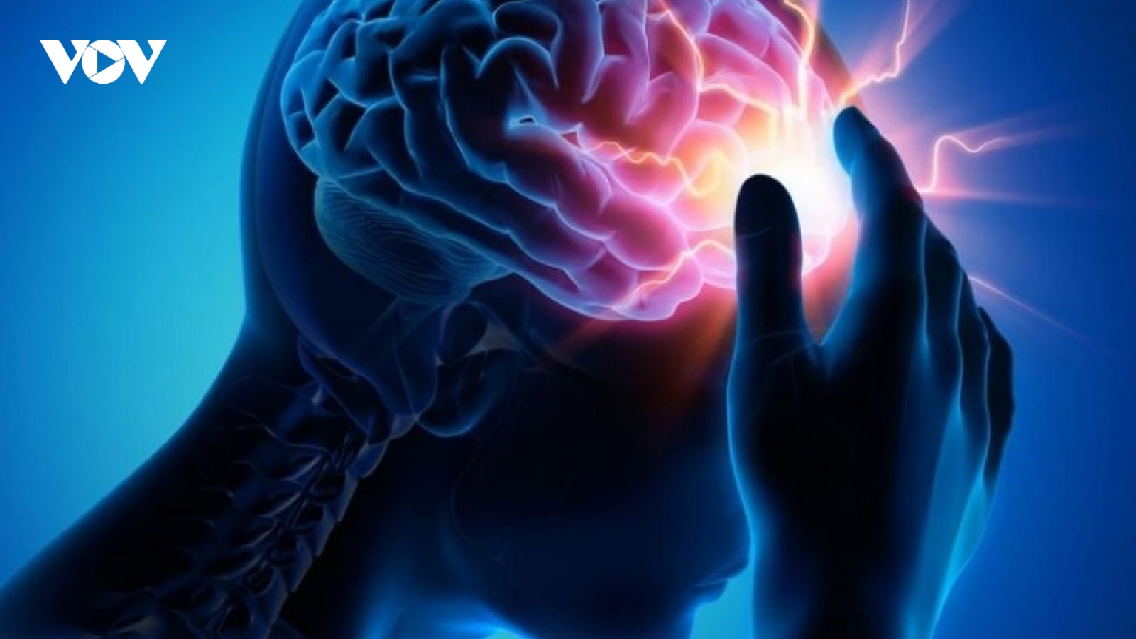 Đột quỵ gây tử vong và tàn phế hàng đầu tại nước ta
