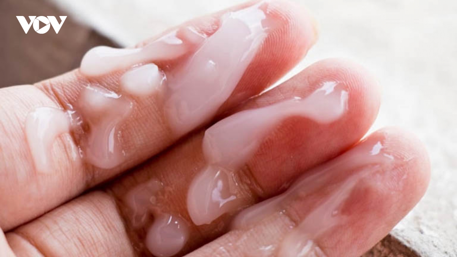 Màu sắc, mùi vị và thể tích của tinh dịch phản ánh điều gì?