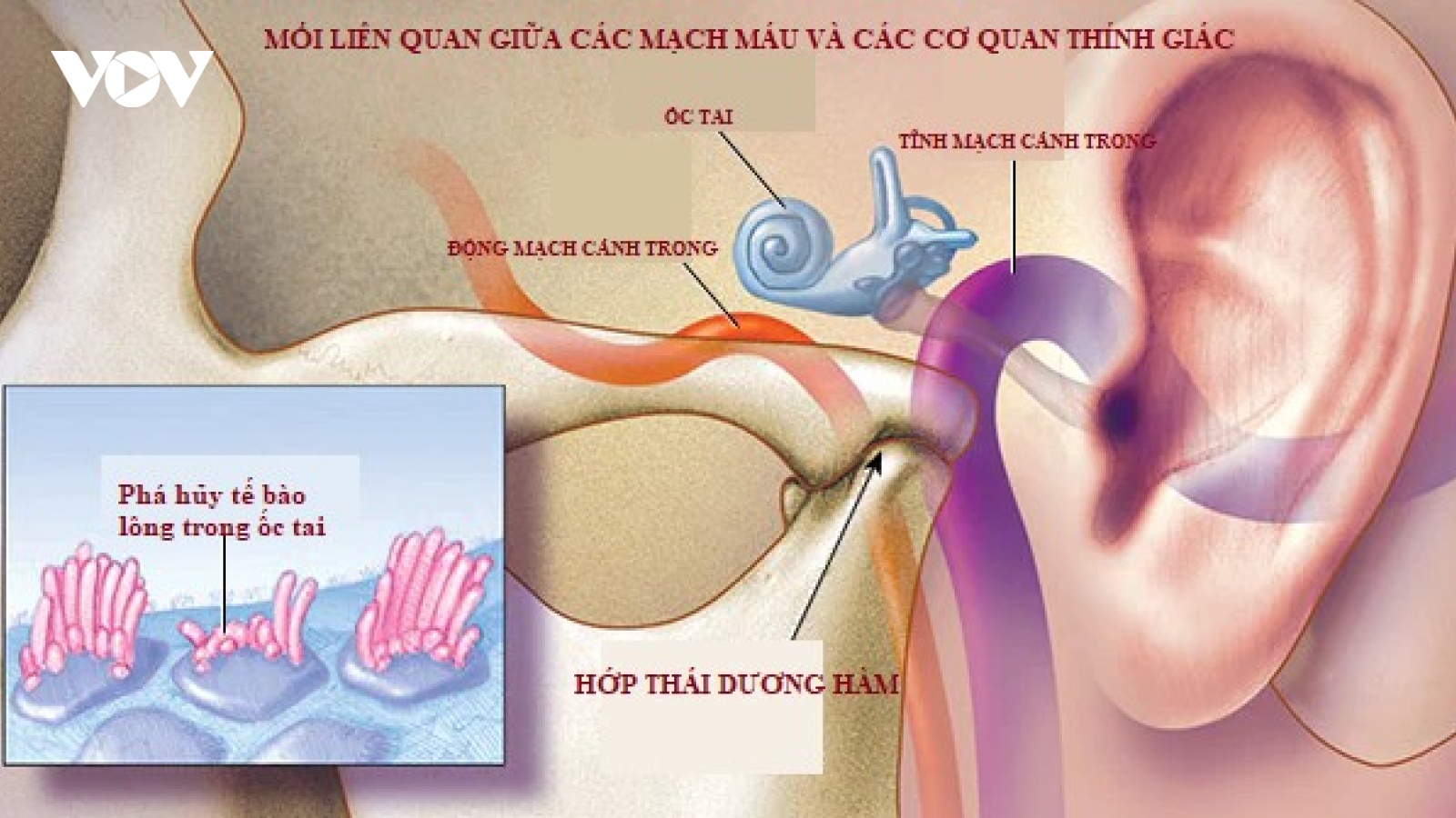 Ù tai có thể là chỉ dấu báo trước về bệnh tim mạch nguy hiểm