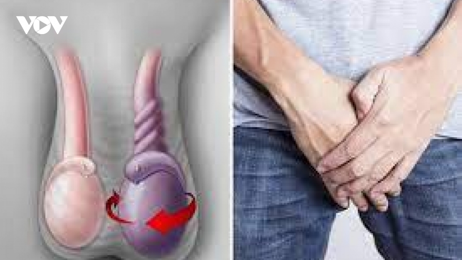 Cảnh giác với chứng xoắn tinh hoàn khi trời lạnh