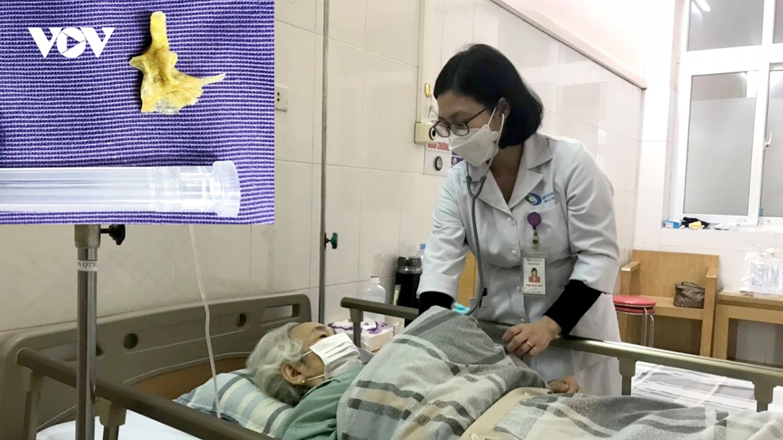 Xương cá ghim trong phế quản cụ bà suốt 2 tháng