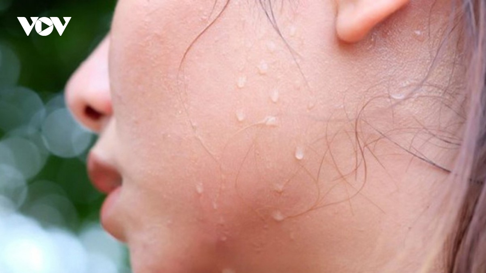 Tác dụng không tưởng của việc đổ mồ hôi đối với sức khỏe