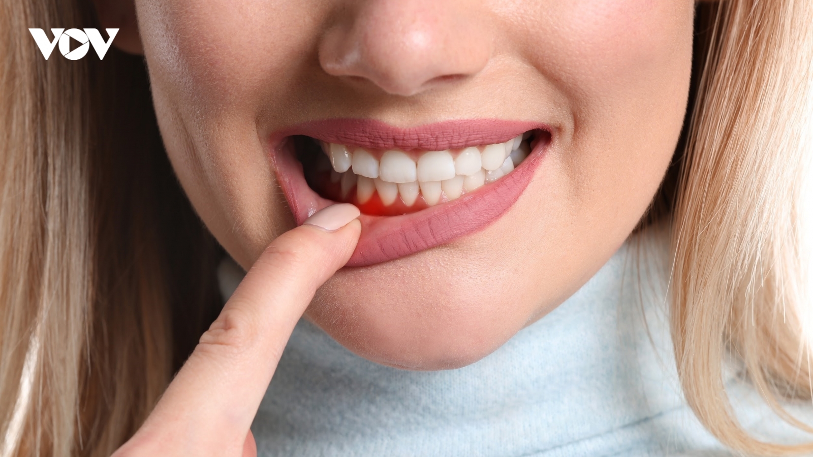 7 hậu quả nghiêm trọng nếu lười đánh răng