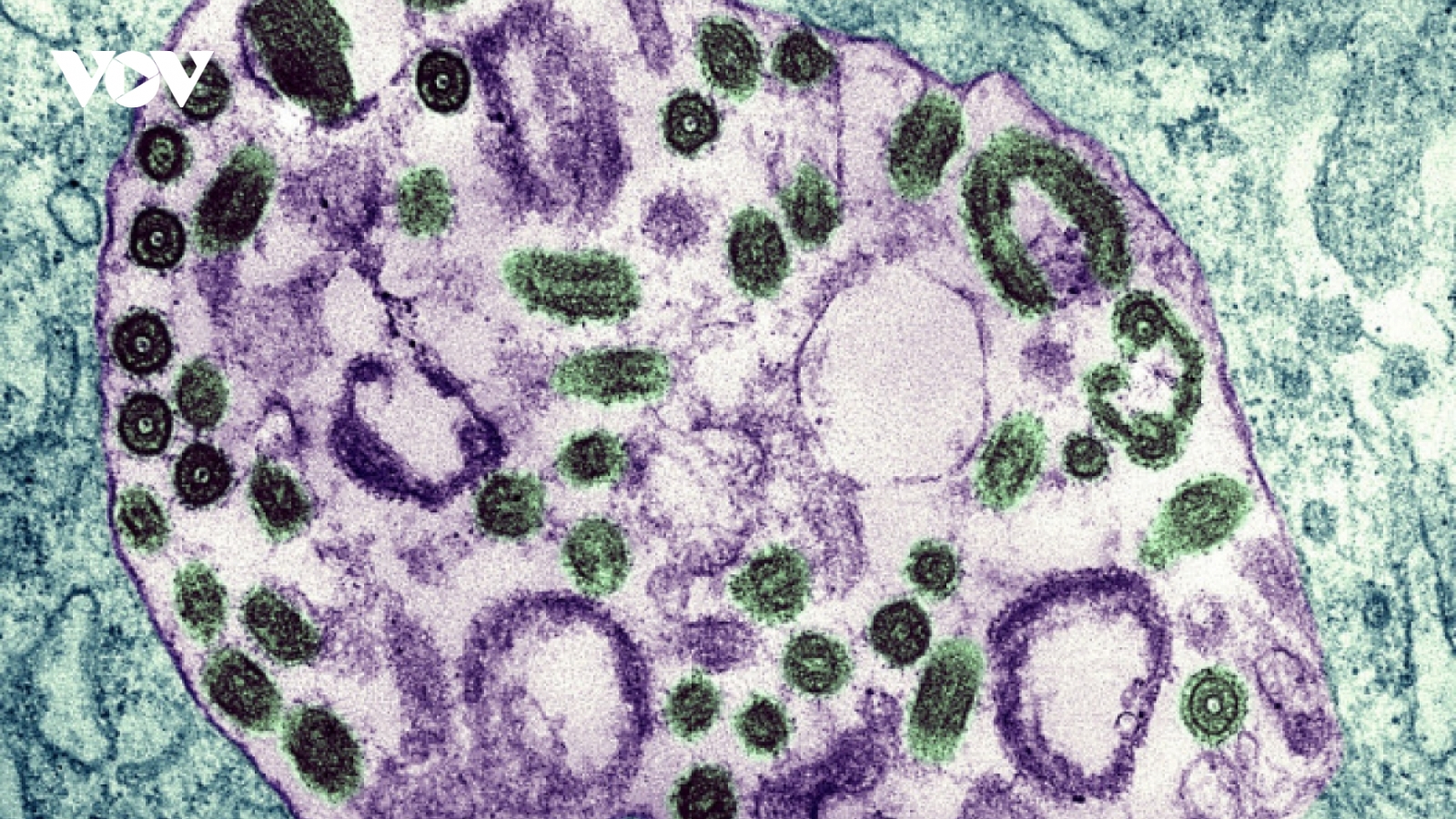 Loại virus khiến 9 người chết sau khi đi dự đám tang
