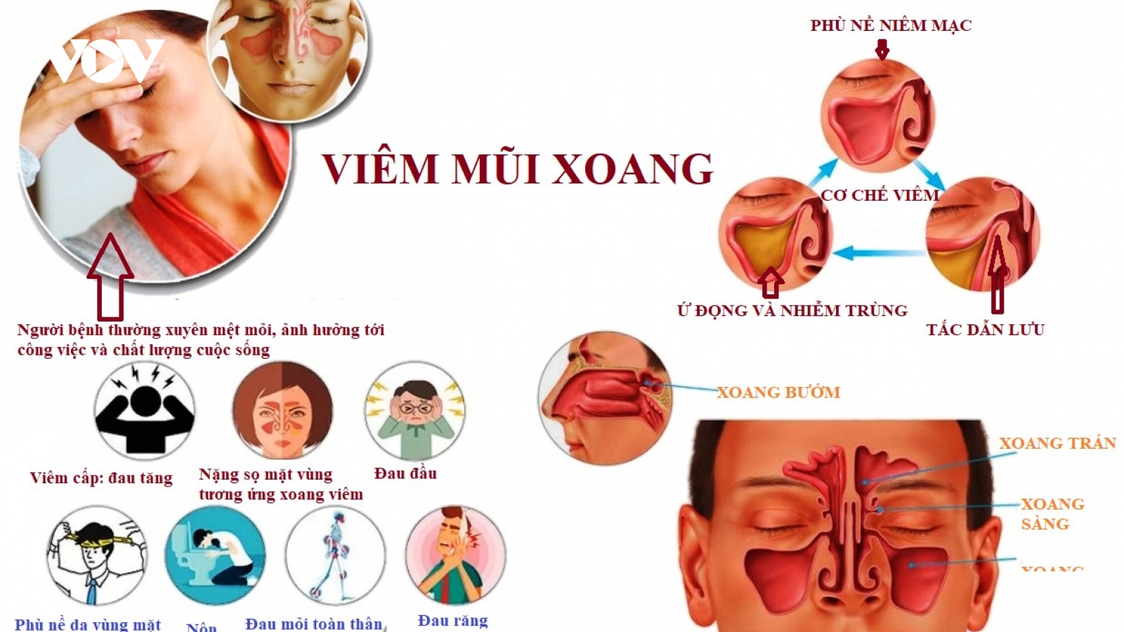Các thói quen xấu dễ dẫn đến viêm mũi xoang