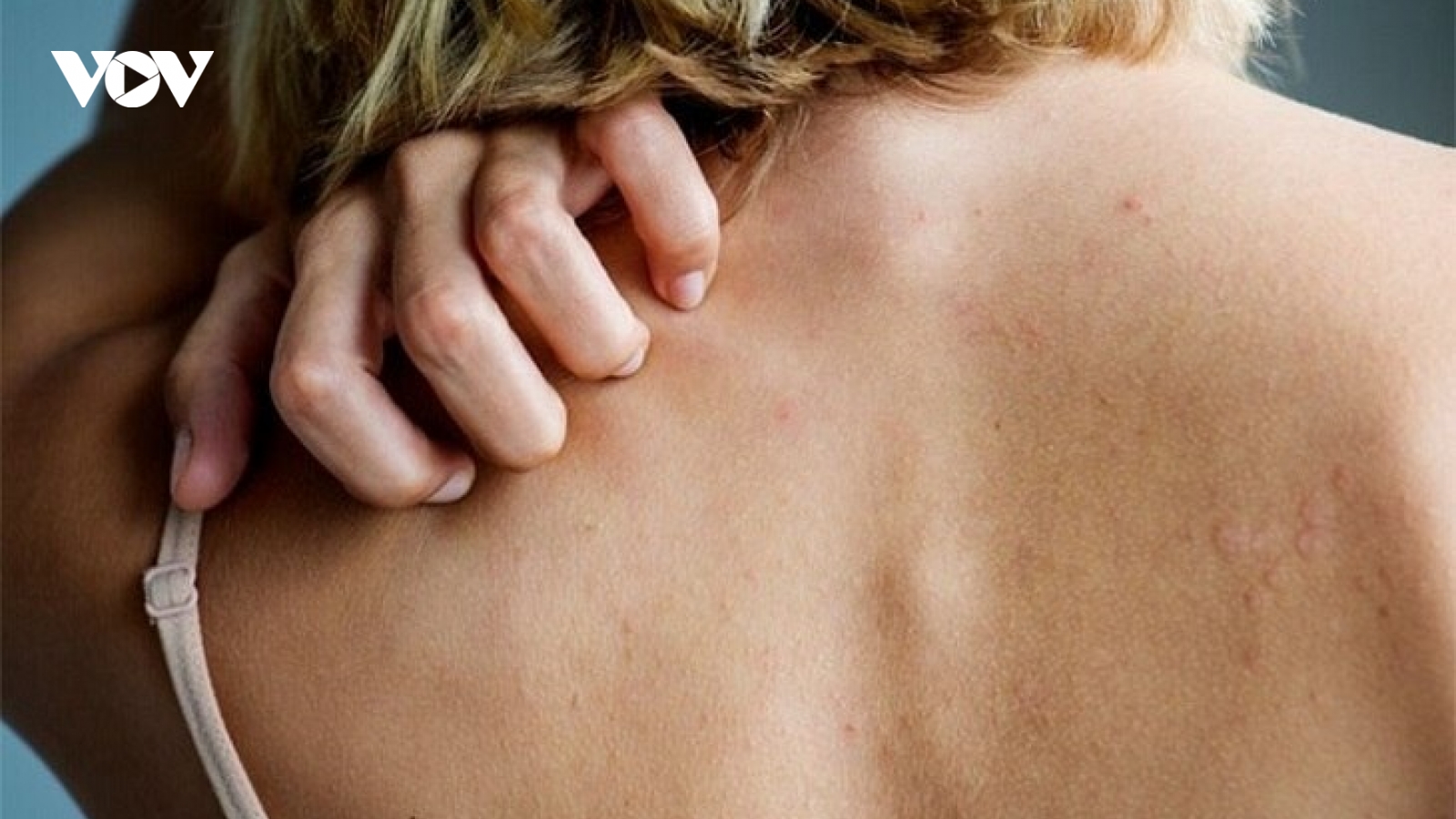 Mức độ nguy hiểm của dị ứng thời tiết