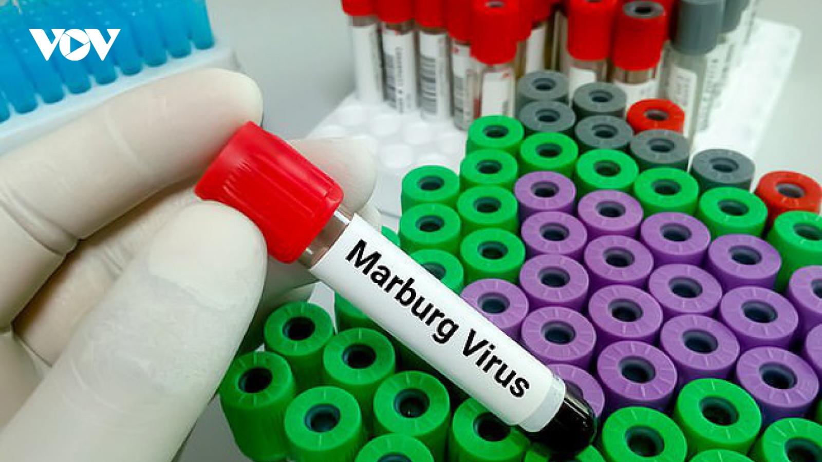 Cảnh giác cao với bệnh do virus Marburg