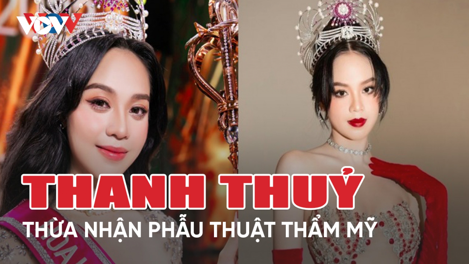 Chuyện showbiz 29/3: Đương kim Hoa hậu Việt Nam thừa nhận phẫu thuật thẩm mỹ