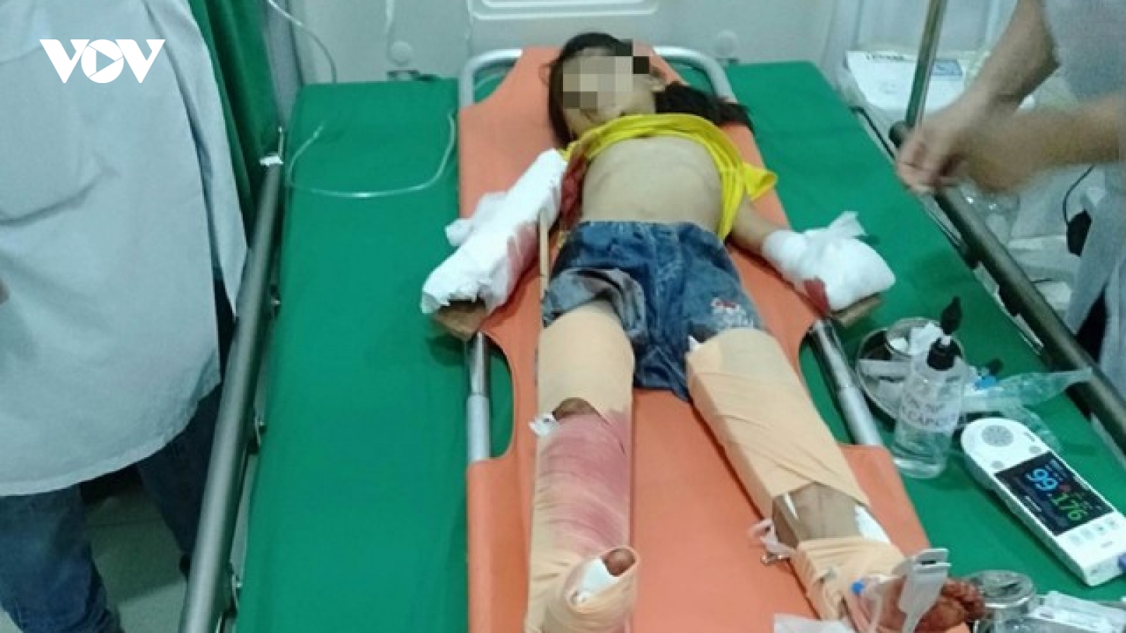 Vụ nổ lớn ở Nghệ An: 3 cháu bé đi xe đạp ngang qua gara ô tô bị hất văng xa