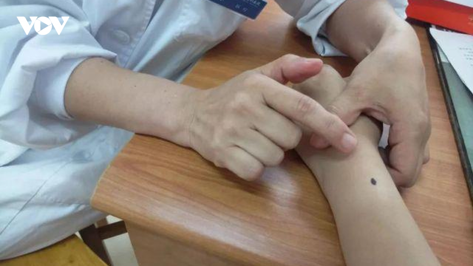 Phát hiện ung thư da từ nốt ruồi dưới mi