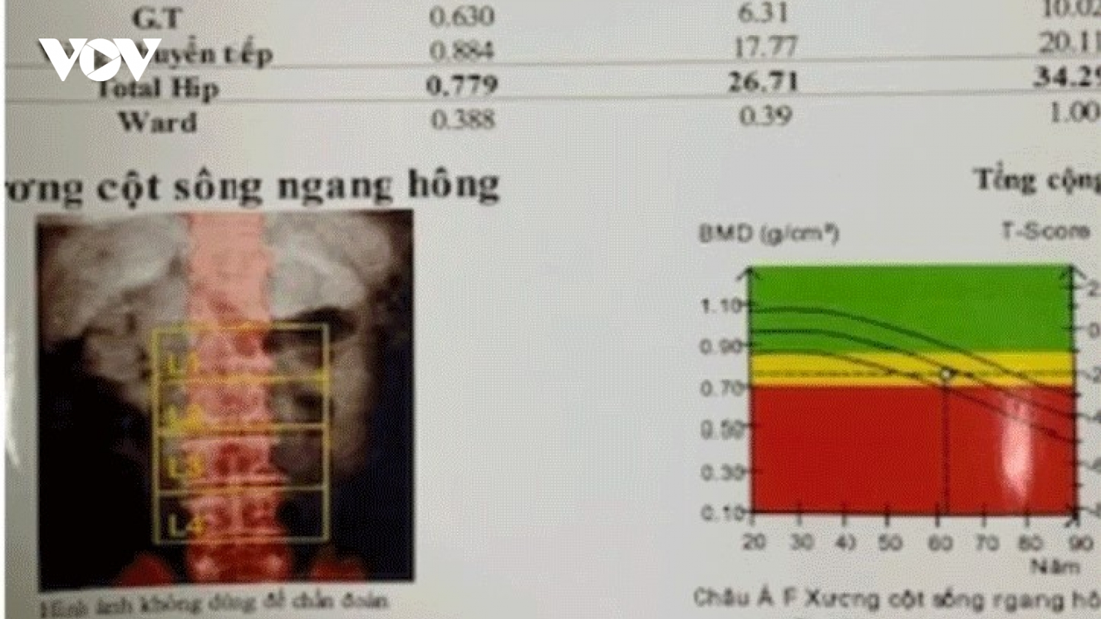 Tự ý mua thuốc điều trị, bác sĩ chỉ ra hậu quả khôn lường