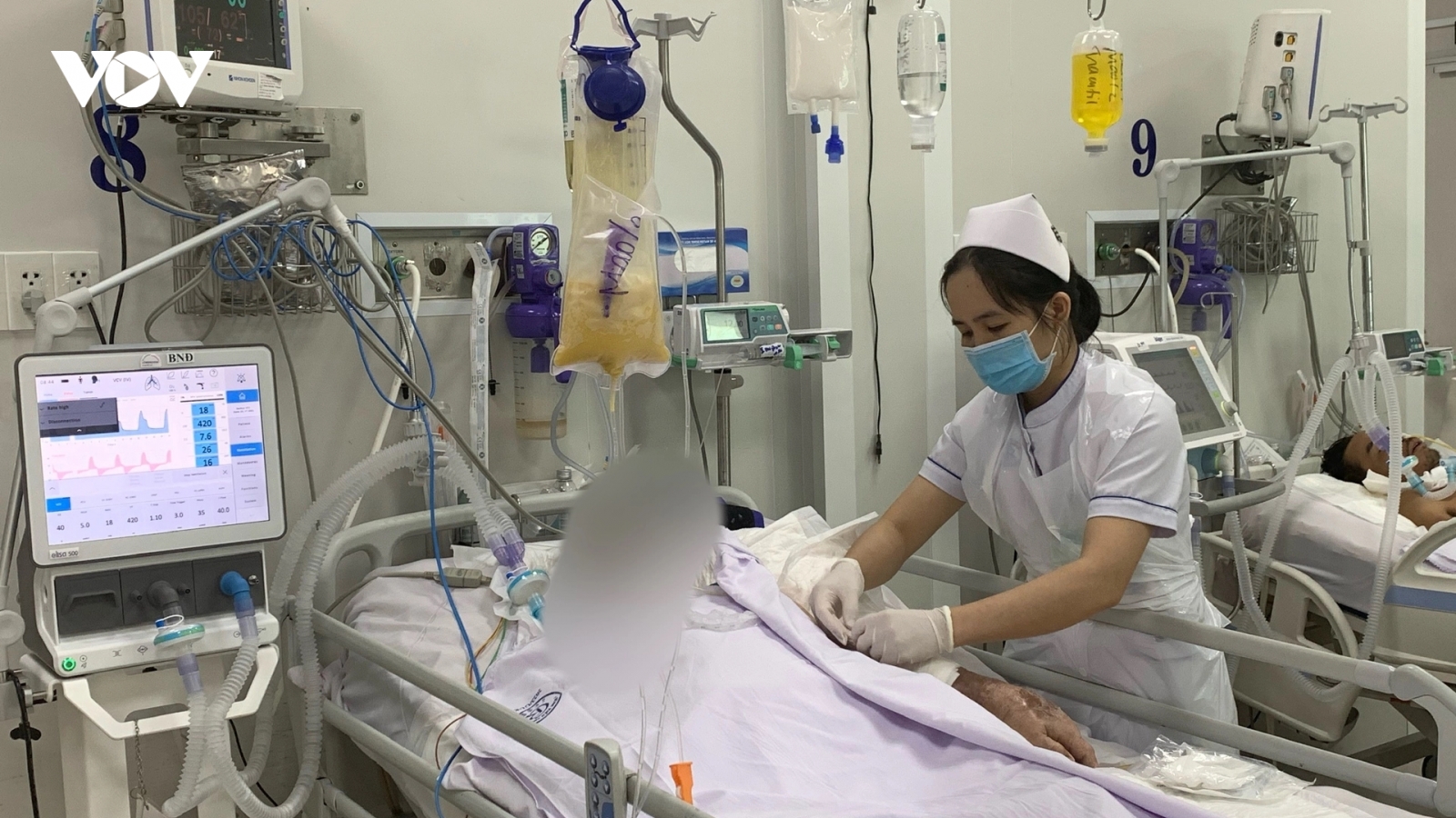 Bệnh viện hết thuốc giải độc, bệnh nhân Botulinum thở máy duy trì
