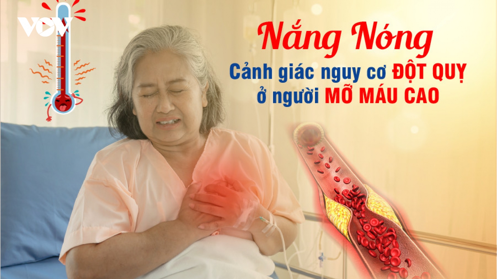 Mùa nắng nóng, cẩn trọng đột quỵ do mỡ máu cao