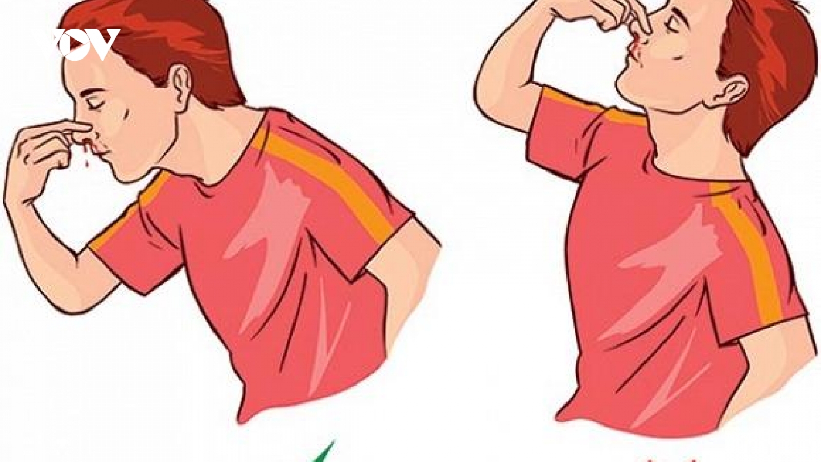 Phương pháp phòng tránh chảy máu cam mùa hè