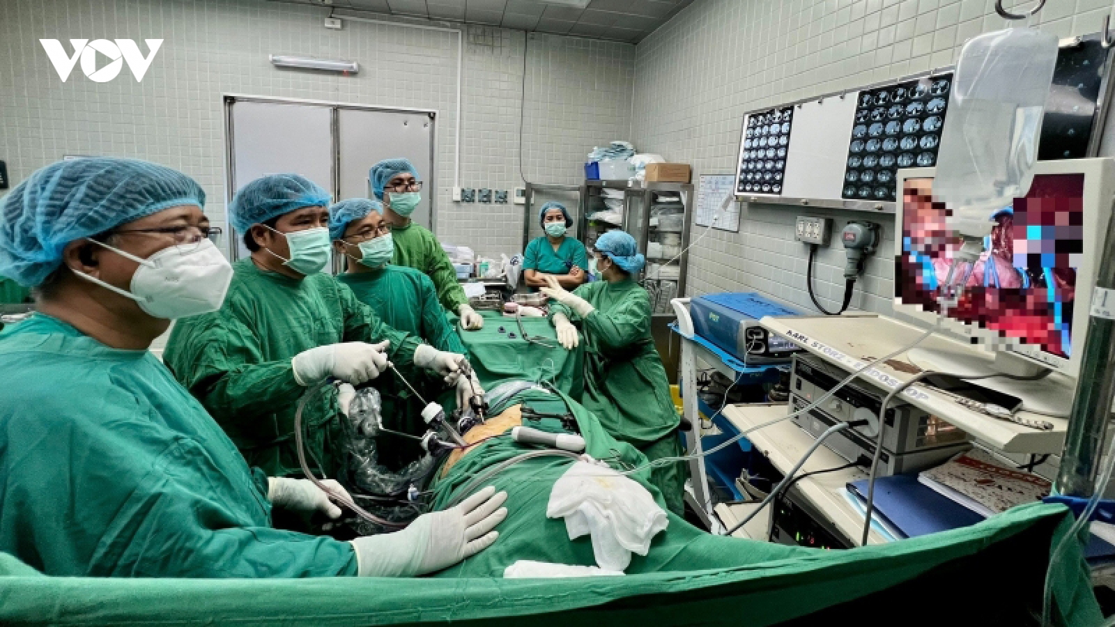Lần đầu tiên phẫu thuật nội soi cứu bệnh nhân ung thư thận có chồi bướu
