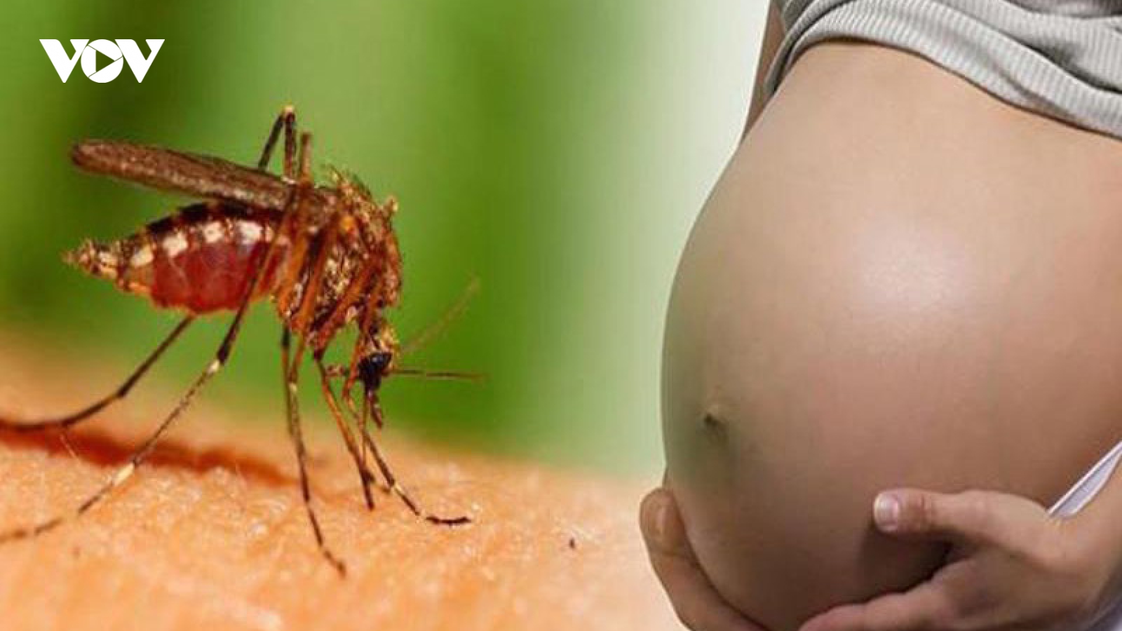Cảnh báo sốt xuất huyết trở nặng ở phụ nữ mang thai