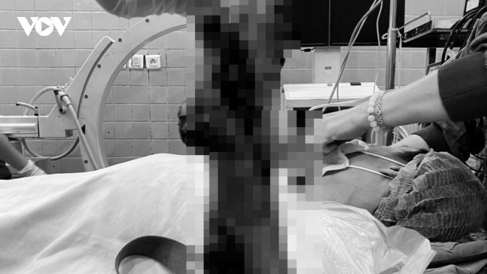 Phẫu thuật khẩn trong đêm cứu bàn tay bị máy cưa nghiền nát