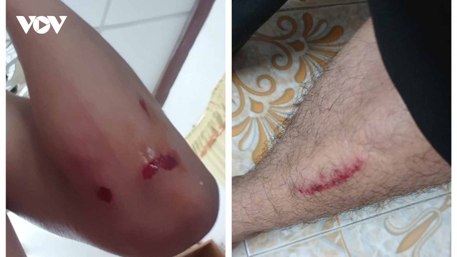 Trộm xe máy rút dao chống trả khi bị "hiệp sĩ đường phố" khống chế