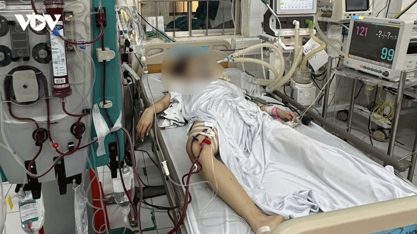 Ngộ độc rượu, 2 dì cháu nhập viện