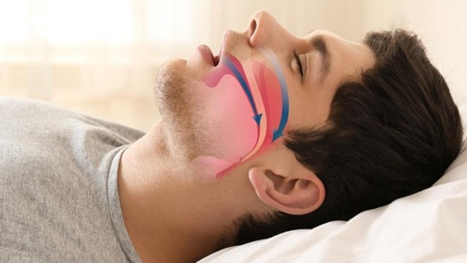 Ngủ chảy nước miếng cảnh báo vấn đề sức khoẻ gì?